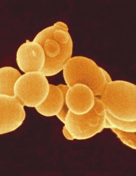 Saccharomyces Cerevisiae, sélectionnée en laboratoire sous la forme 71 B, produit de facétieux arômes fruités chimiques de banane (©Lallemand)